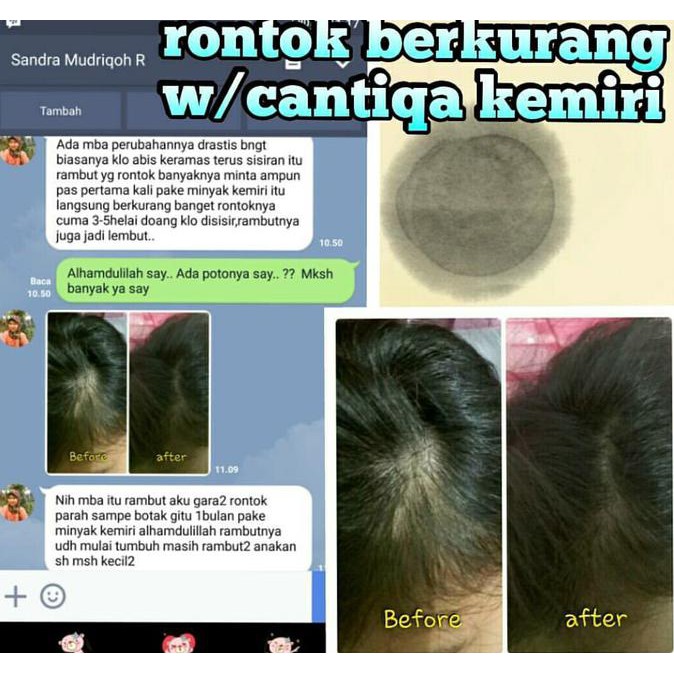 EKSKLUSIF PENYUBUR RAMBUT HERBAL, ALAMI & AMAN CANTIQA KEMIRI BEST SELLER PERAWATAN RAMBUT MURAH