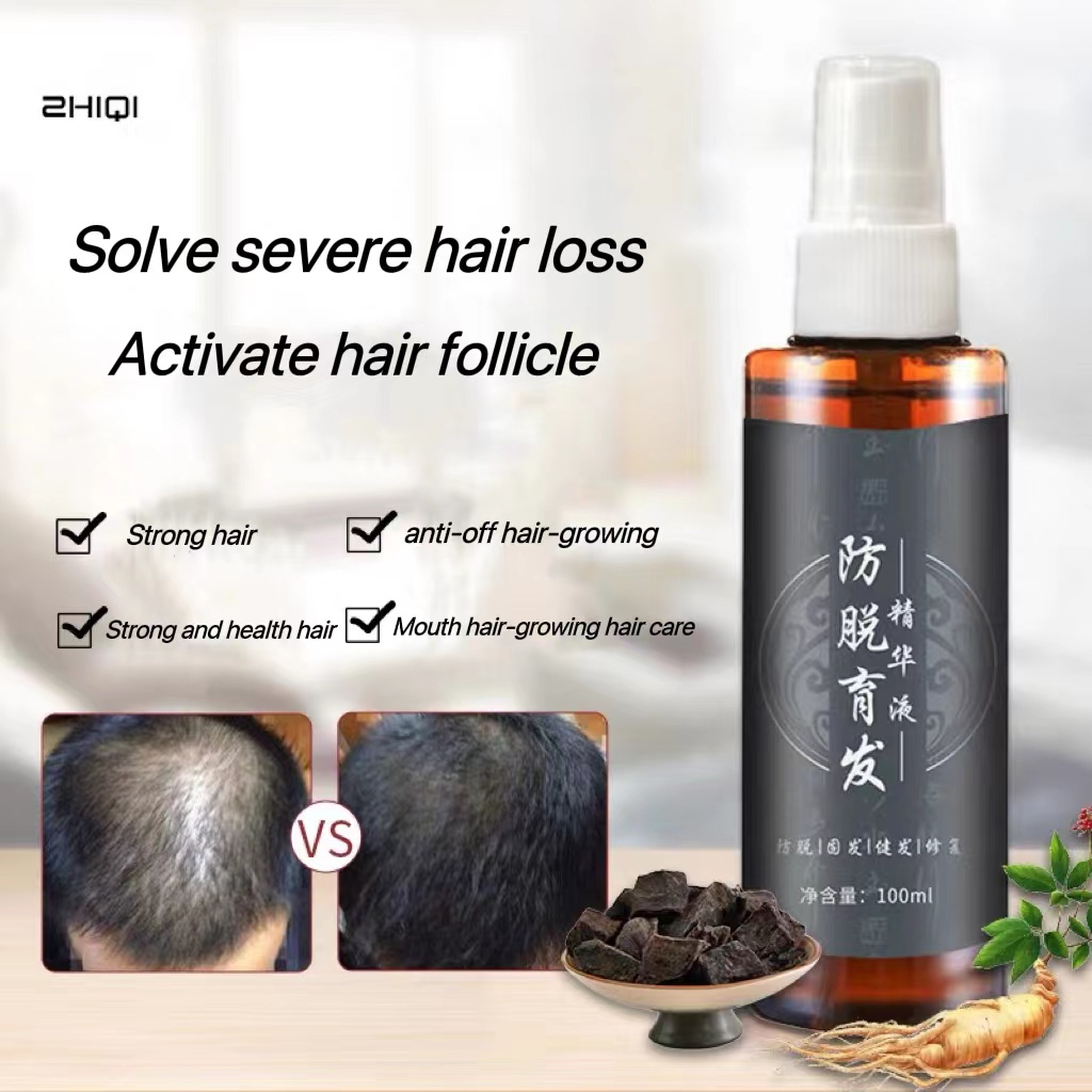 Anti hair loss Hair Growth Serum Spray Original Obat Penumbuh Rambut Botak Rontok Pria Wanita Ampuh 
