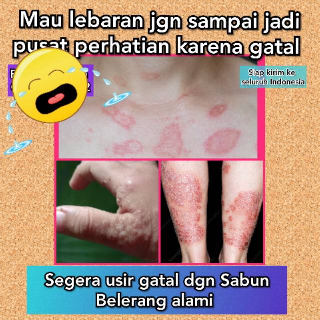 Sabun belerang Murni