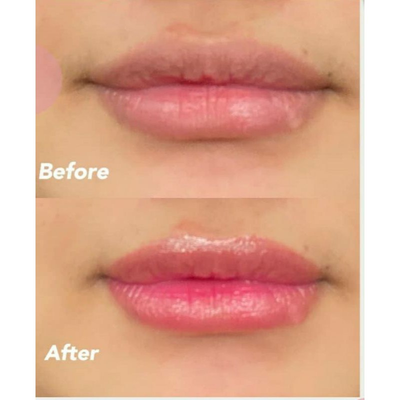Collagen lip serum esenses