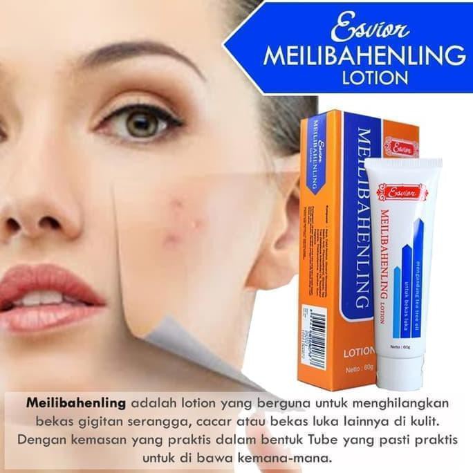 BIO HERBAL Meilibahenling Original Penghilang Bekas Luka HItam Bopeng Koreng /Jerawat Permanen