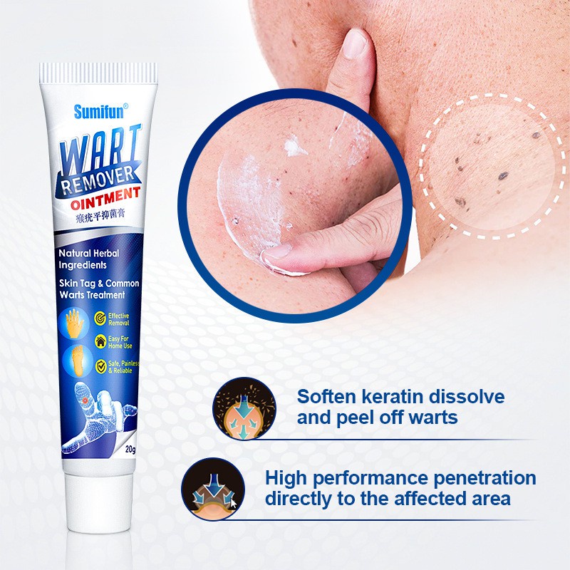 Sumifun Wart Removal Cream Skin Tag Remover 20g - Menghilangkan Kutil Tahi Lalat Mata Ikan Penghilang Tahi Lalat