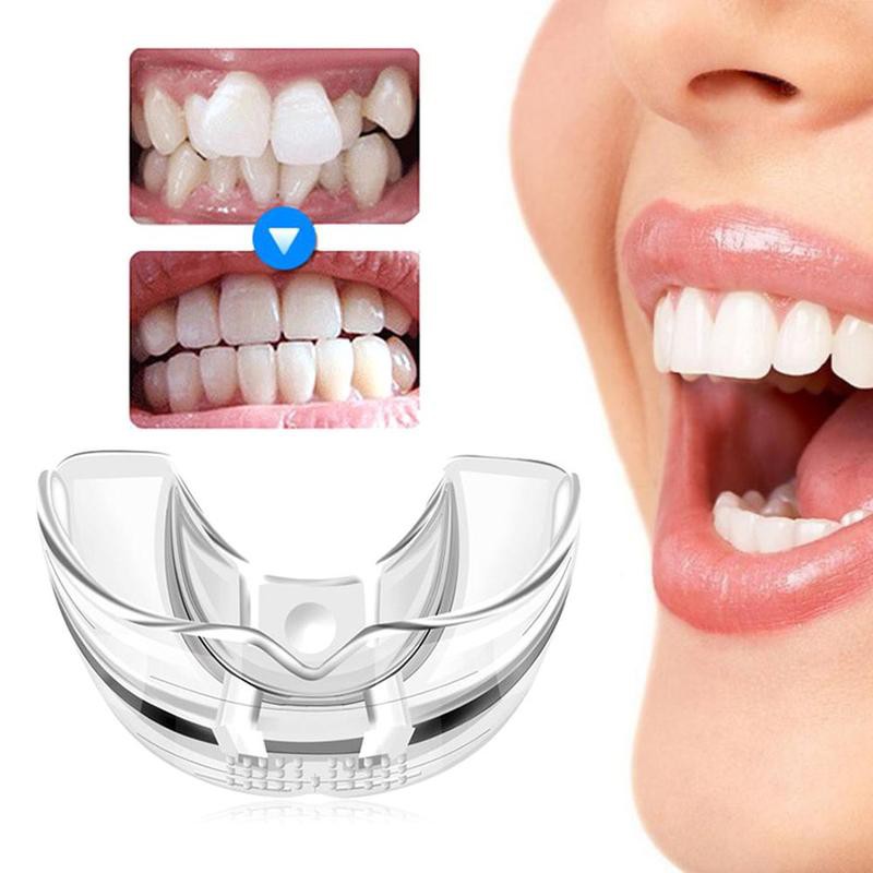 [Putih] Perapi Gigi Tanpa Behel dari Bahan Silikon Orthodentic Retainer Teeth Ampuh dalam 3 Bulan