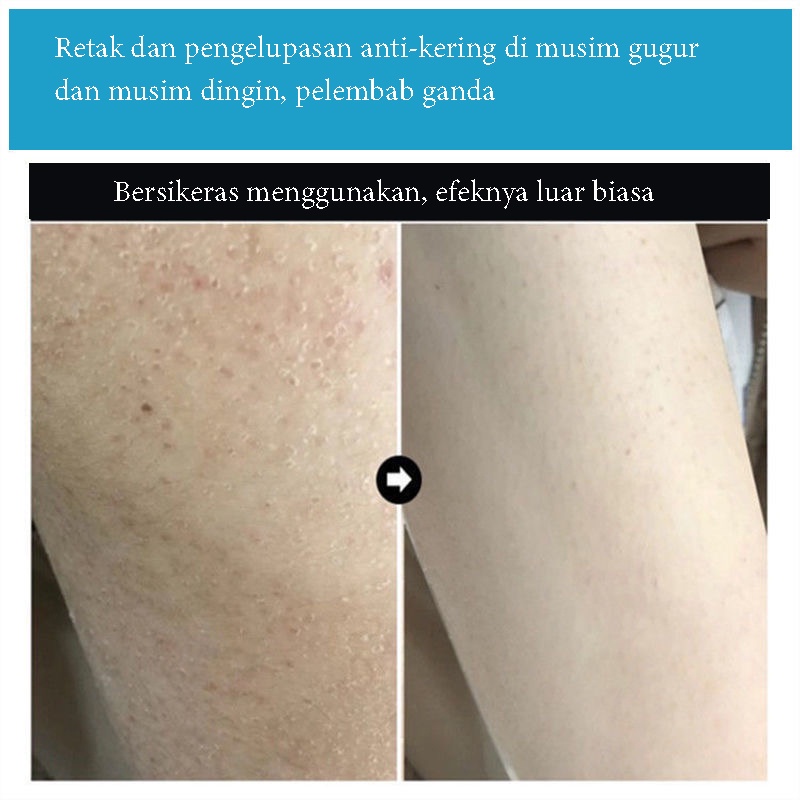 lotion pemutih badan 60g  sabun pemutih badan Kulit anti pecah-pecah/menghilangkan ketombe/selamat tinggal kulit ayam/melembabkan Brightening Body Lotion Lotion Serum