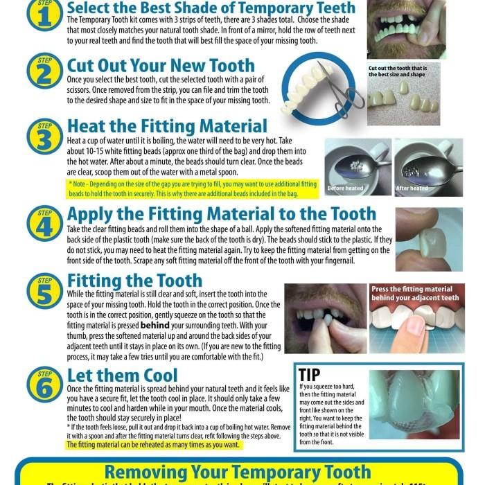 Gigi Palsu Instan Tempel Temporary Tooth Kit