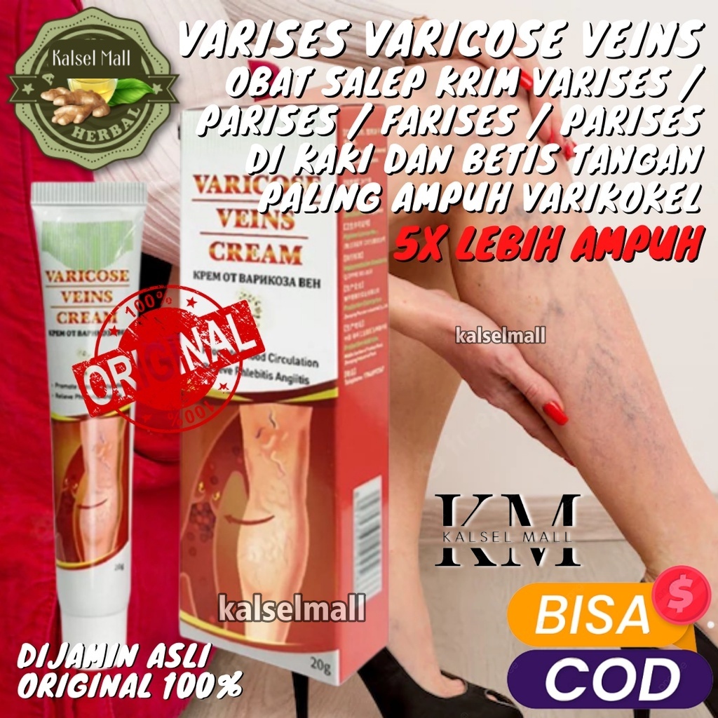 Obat Salep Krim Cream Varises Parises Farises Kanyehb ORIGINAL 100% Kaki Betis Kemaluan Testis Tangan Urat Membengkak Varicose Veins Paling Ampuh Ramuan Cina Herbal Tradisional OC11