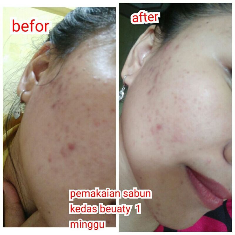 kedas beauty sabun, Gold jelly kedas beauty, body serum kedas beauty,body scrub kedas beauty-5