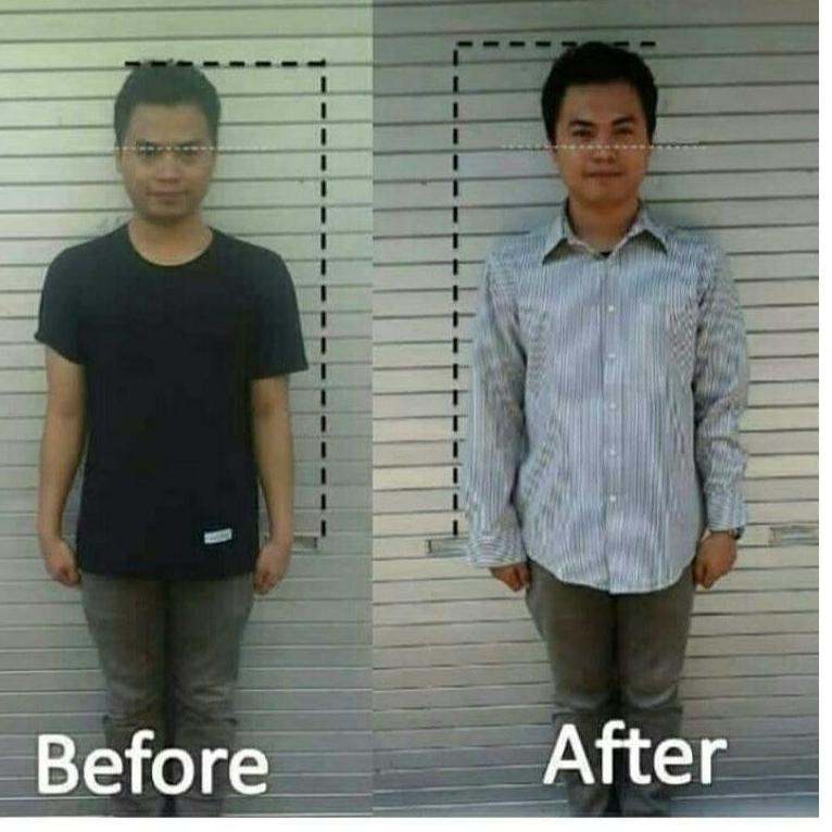 

[KODE BARANG J967F] [COD] PAKET PENINGGI BADAN TERBAIK | PENINGGI TUBUH ALAMI | ZINC + SUSU CALSIUM