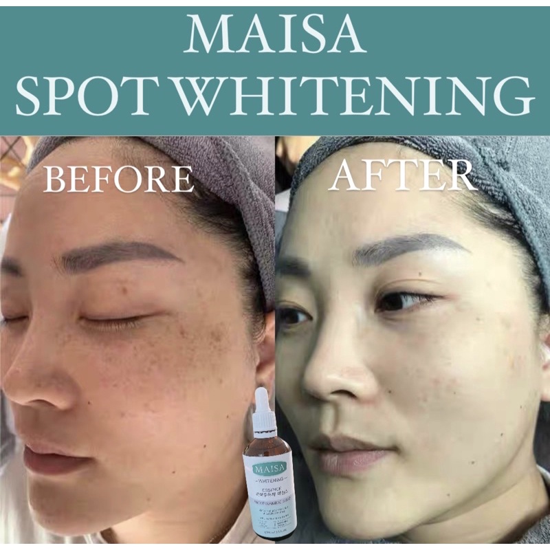 MAISA SPOT WHITENJNG ESSENCE