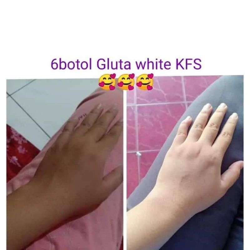 Gluta kfs original (susu collagen)