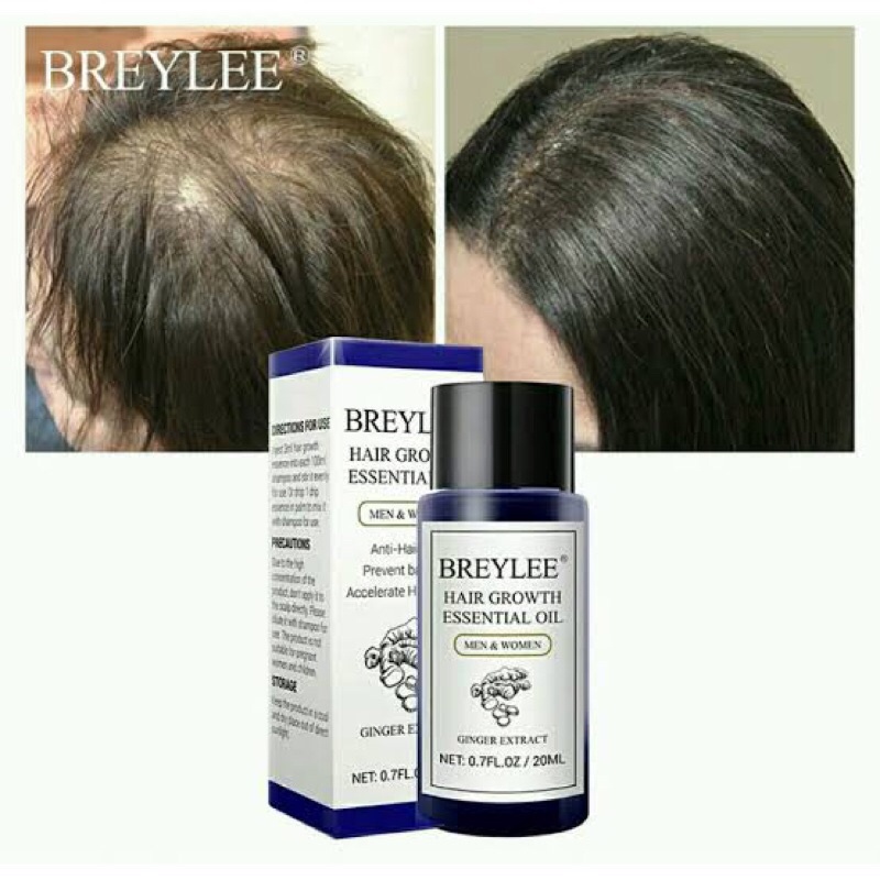 Breylee Hair Growth Essential Oil 20ml