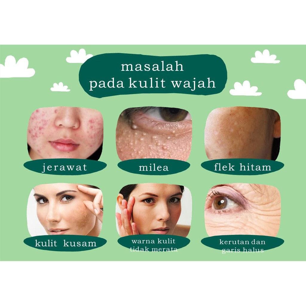 ( BISA COD ) SKINCARE PENGHILANG FLEK, JERAWAT, BRUNTUSAN  BISA UNTUK BUMIL DAN BUSUI