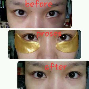 Peredam Mata Masker Mata Emas / Gold Collagen Crystal Eye Mask Onehand