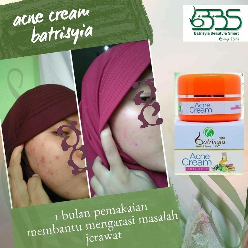 Batrisyia Acne cream/ cream totol jerawat