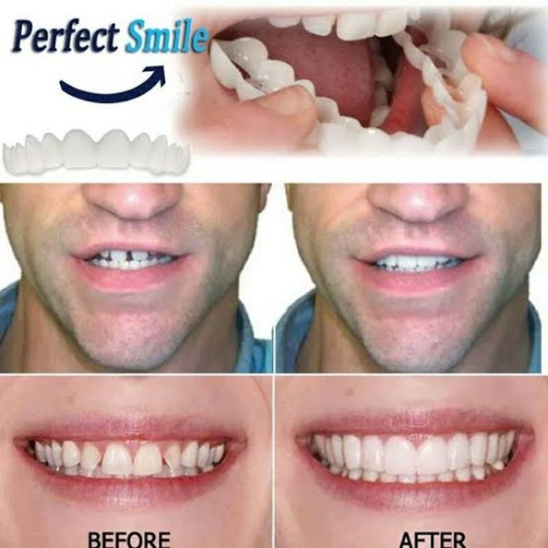 Snap On Smile Gigi Palsu Mainan | Set Atas Bawah Original 100% GROSIR dan ECER