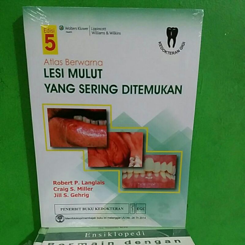 Buku Atlas Berwarna Lesi Mulut Yang Sering Ditemukan