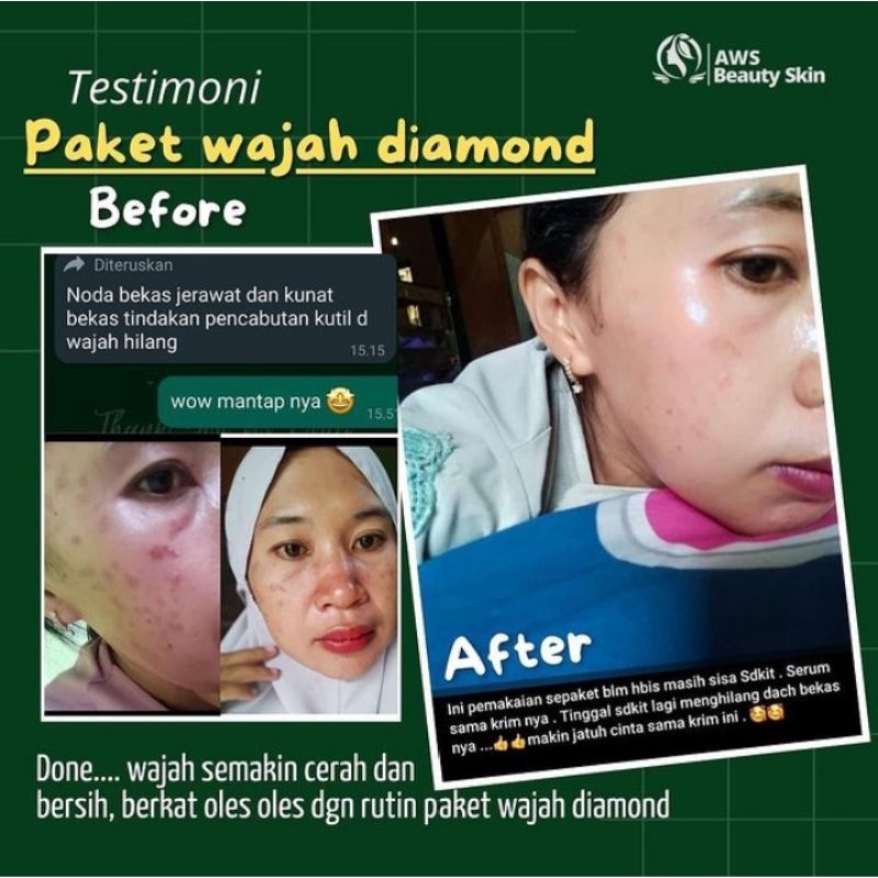 Paket perawatan wajah berkwalitas super.-6