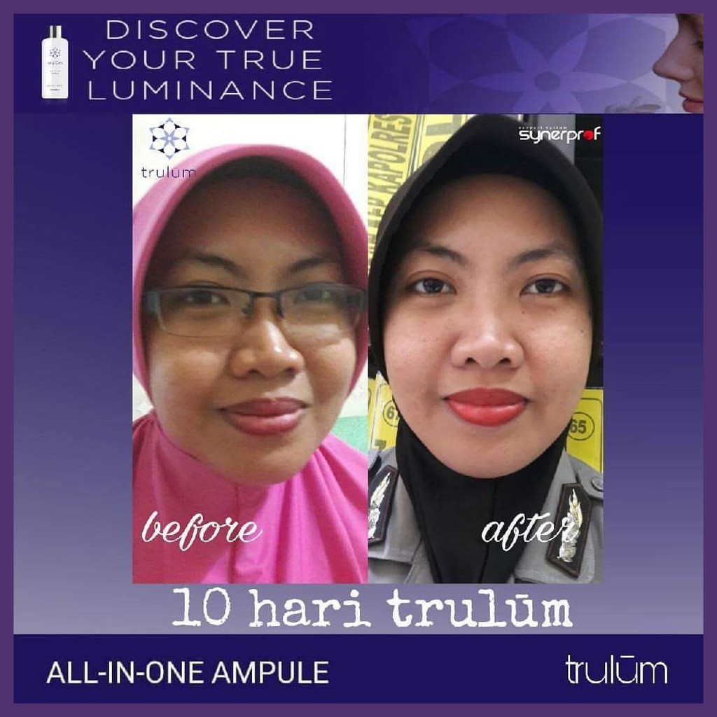 Pemutih Wajah Penghilang Jerawat Trulum 15ml Trulum Penghilang