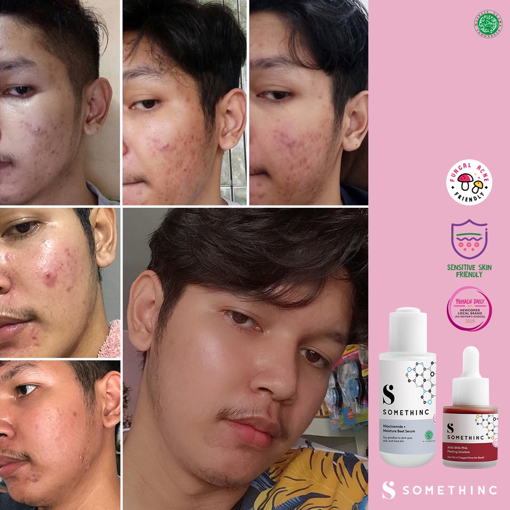 SOMETHINC AHA BHA PHA Peeling Solution