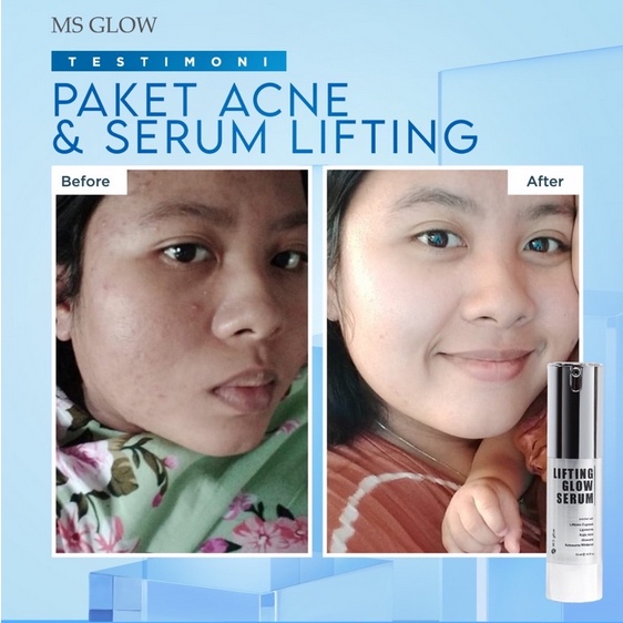 MS GLOW Lifting Serum ORIGINAL