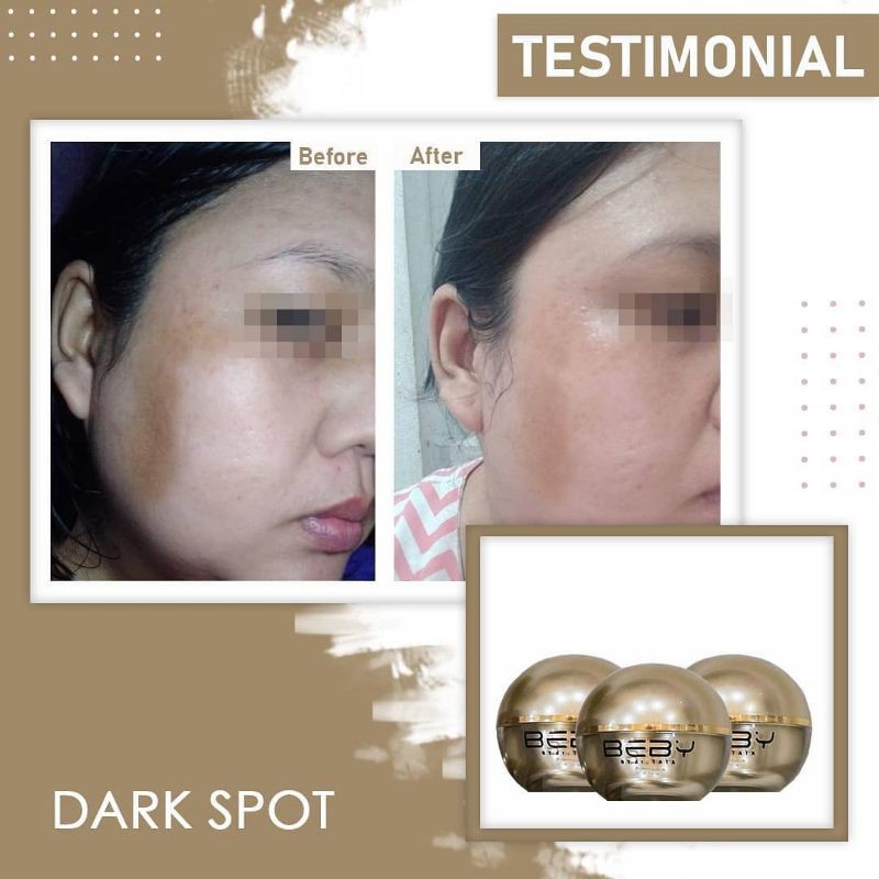 PROMO MURAH DARK SPOT( ANTI FLEK)