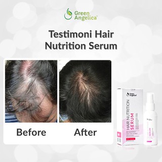 Serum Vitamin  Rambut  Rusak Kering  Bercabang  Patah Penumbuh 