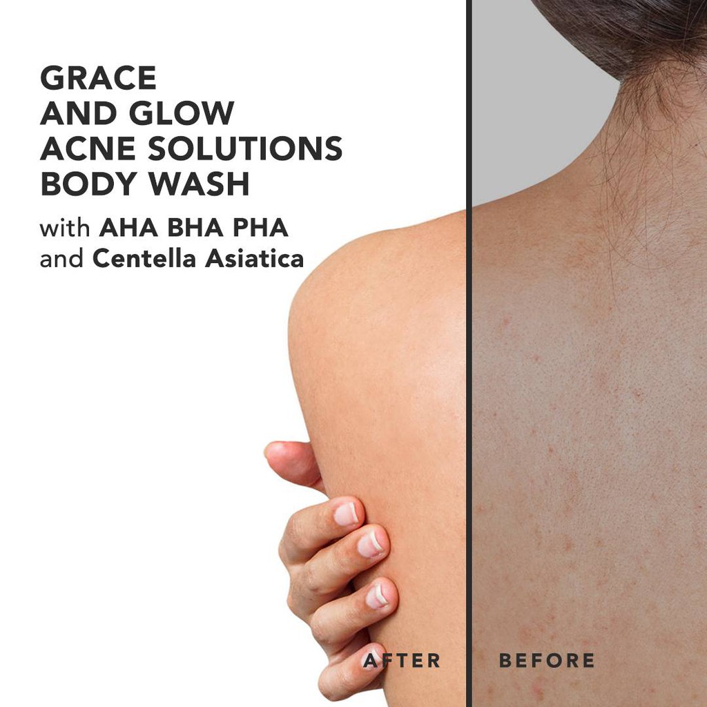 Grace and Glow English Pear and Freesia Anti Acne Solution Body Wash + Body Serum