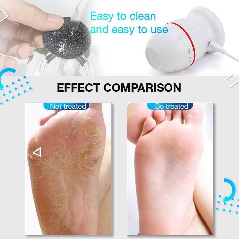 Electric Foot Grinder / Vacuum Adsorpt Dead Skin Callus Remover File Machine / Pedicure Foot Clean Tools Feet Care