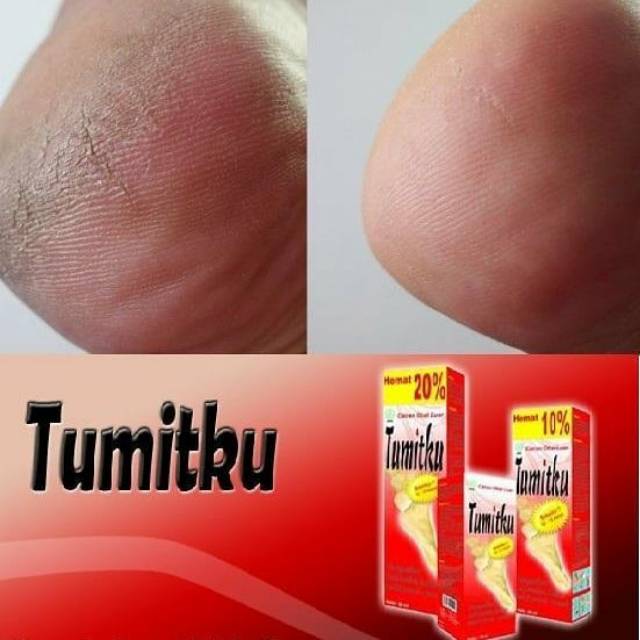 OBAT KAKI PECAH DAN KERING TUMIT TUMITKU ORIGINAL 30ML BPOM AMPUH