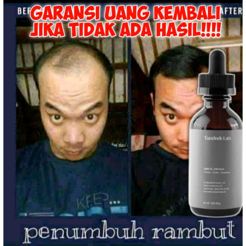 TUMBUH LAB *PAKET SILVER*
