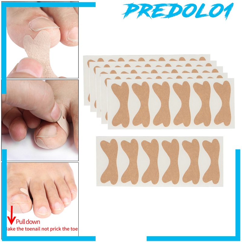[PREDOLO1]Ingrown Toenail Stickers Elastic Glue Free Painless Nail Correction Foot nail Patches for Women Men