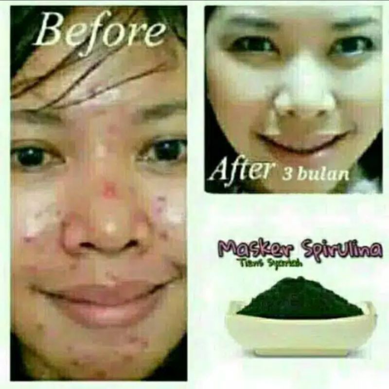 MASKER KAPSUL SPIRULINA ORIGINAL PURE ASLI