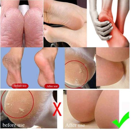 PELINDUNG TUMIT KAKI DARI SILICONE YANG LEMBUT