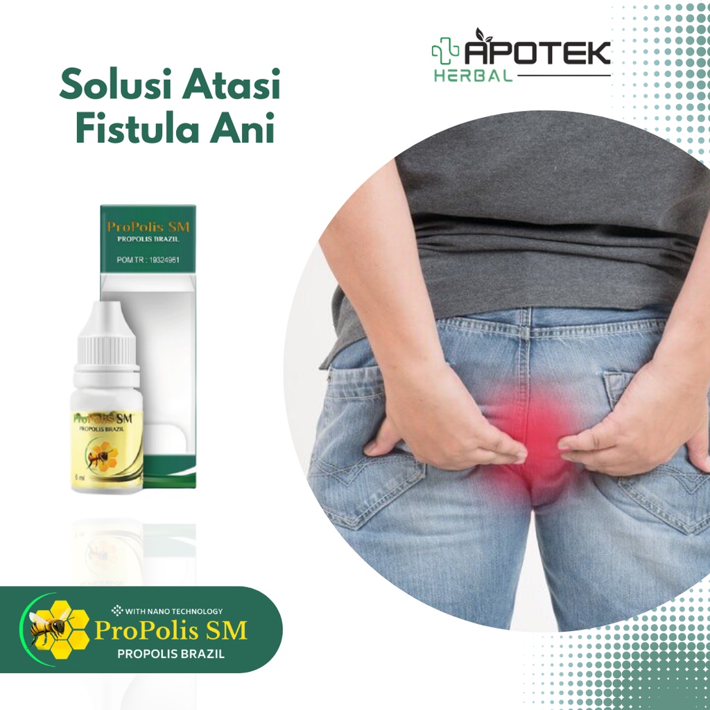 Obat Fistula Ani - Obat Abses Anus, Benjolan Bernanah di Anus, Fisura Ani, Anus Gatal, Obat Anus Ben