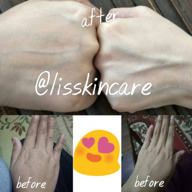 PROMO HB WHITENING BPOM DOSIS TINGGI ANTI STREATMARK / BACA DESKRIPSI / BERKUALITAS di jamin putih dan ori 100% dosis tinggi / Ampuh Putih