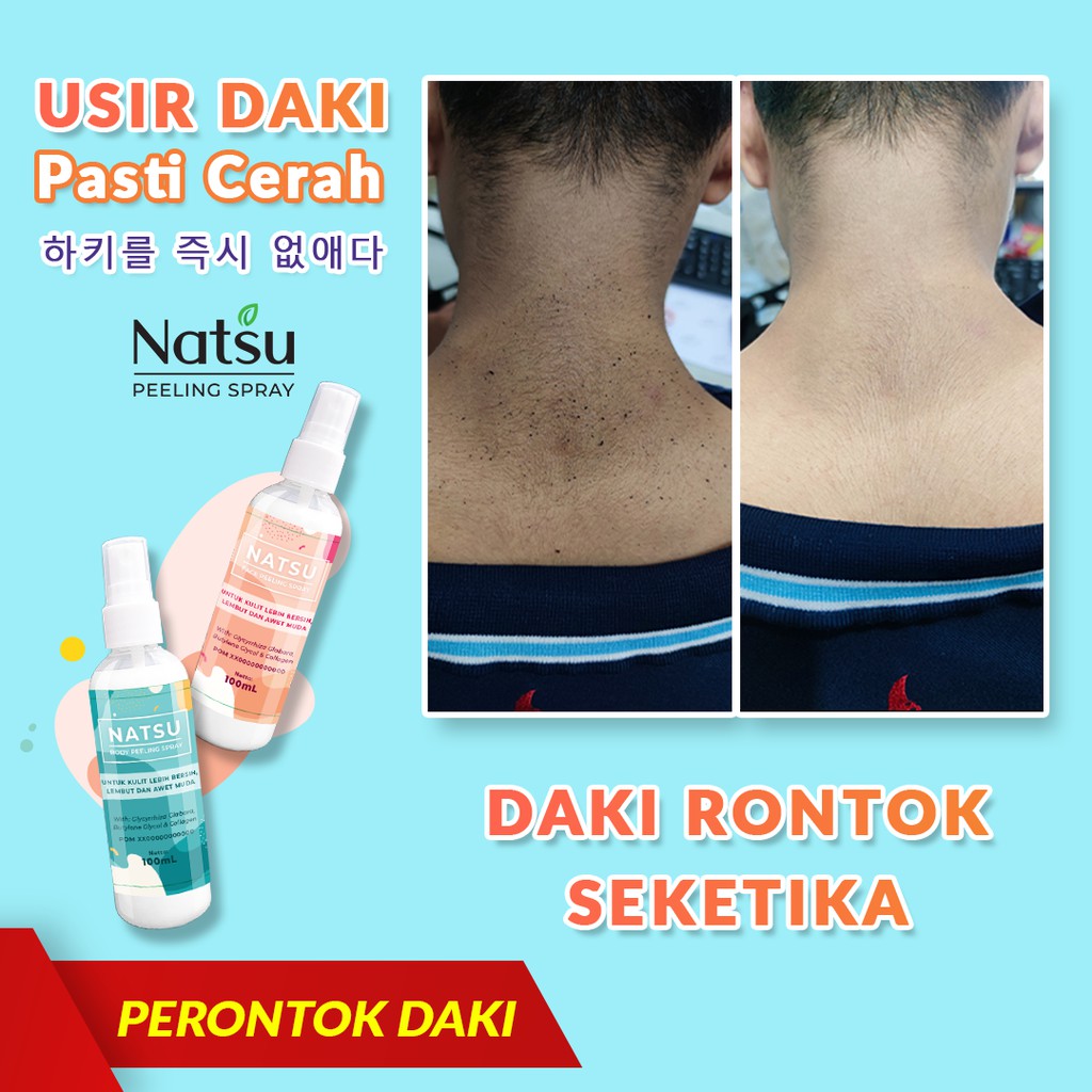 Natsu Peeling Spray Menghilangkan Daki Melembutkan Kulit Serta Memutihkan Kulit Secara Merata