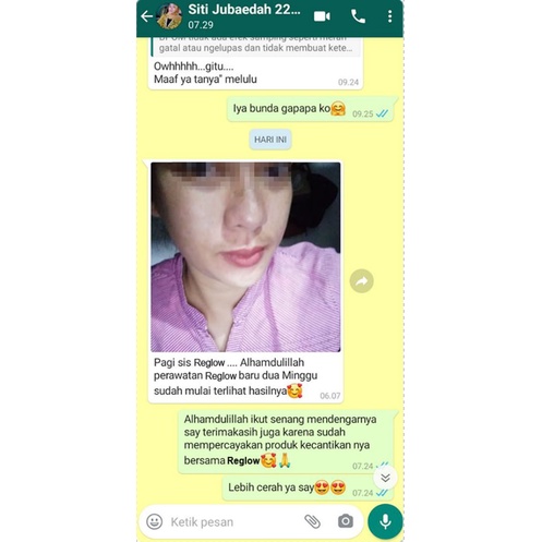 Cream REGLOW Untuk menghilangkan Flek Jerawat Kerutan-8