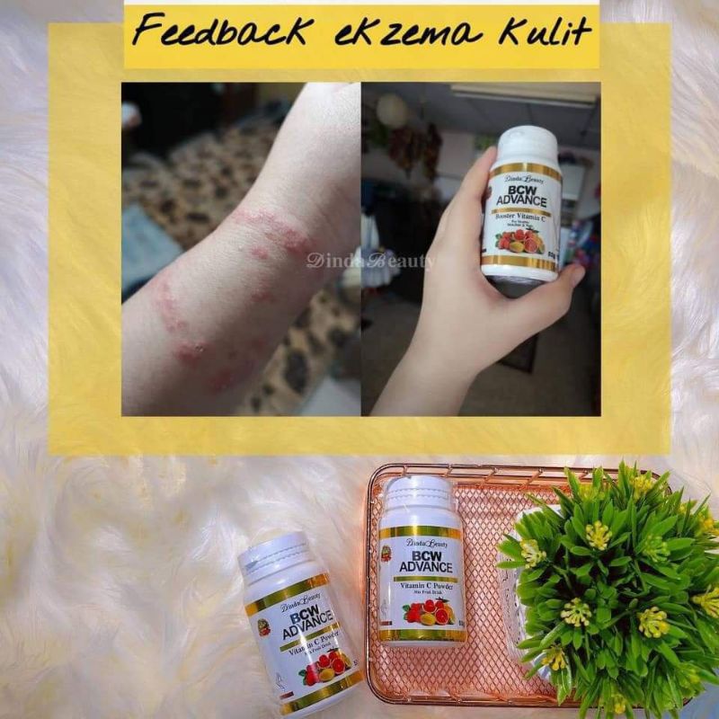 BCW ADVANCE pemutih instan original malaysia