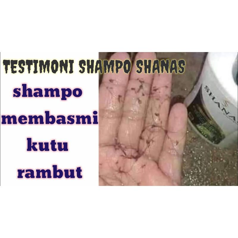 COD FREEONGKIR Shampo Kutu Shanas Sampo Sanas Anti Lepek Ketombe Dan Bau