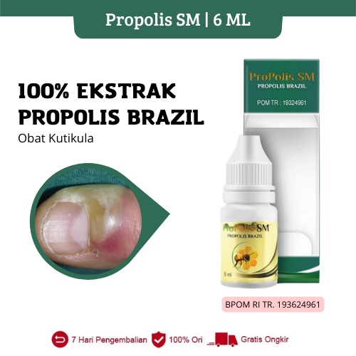 Propolis SM - Obat Kulit Jari Dekat Kuku Mengelupas (Kutikula) - Salep Jari Tangan Mengelupas