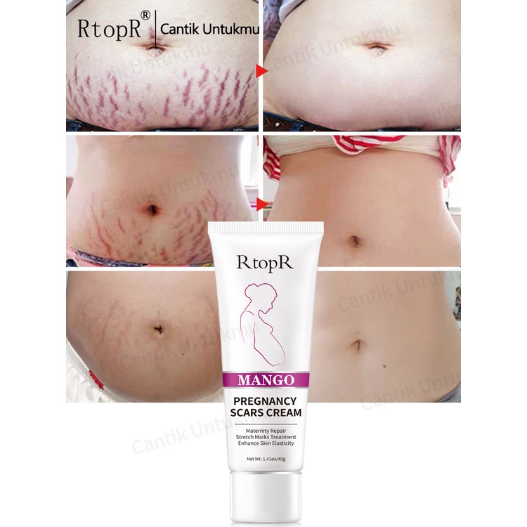 RtopR Body Care Series Exfoliating Cream /Body Slimming Cream /Breast Enlargement Cream/ Buttock Cream/ Pregnancy Scars Masks Removel Cream/Neck Firming Rejuvenation Cream
