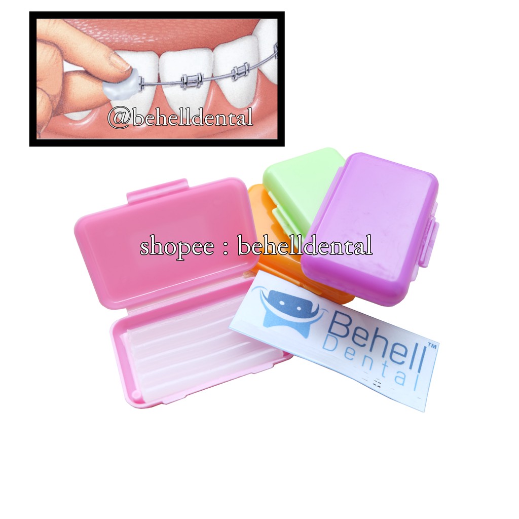 Behelldental Wax Ortho Pencegah Sariawan . Lilin behel dental . Kawat gigi