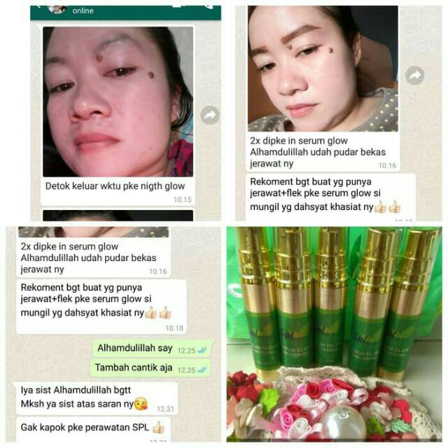 Spl Skincare Paket Derma Glow Glowing Original Untuk Wajah Yg Susah Putih Shopee Indonesia