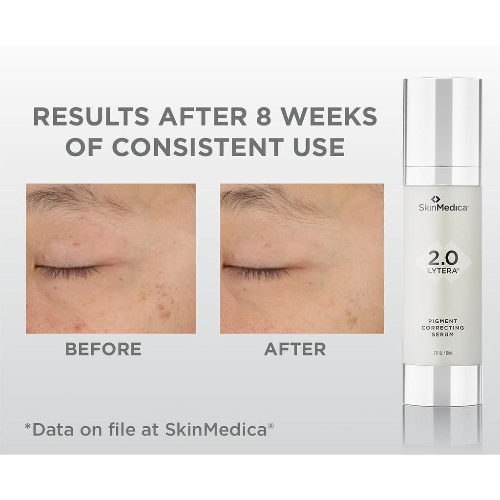 pigment correcting serum