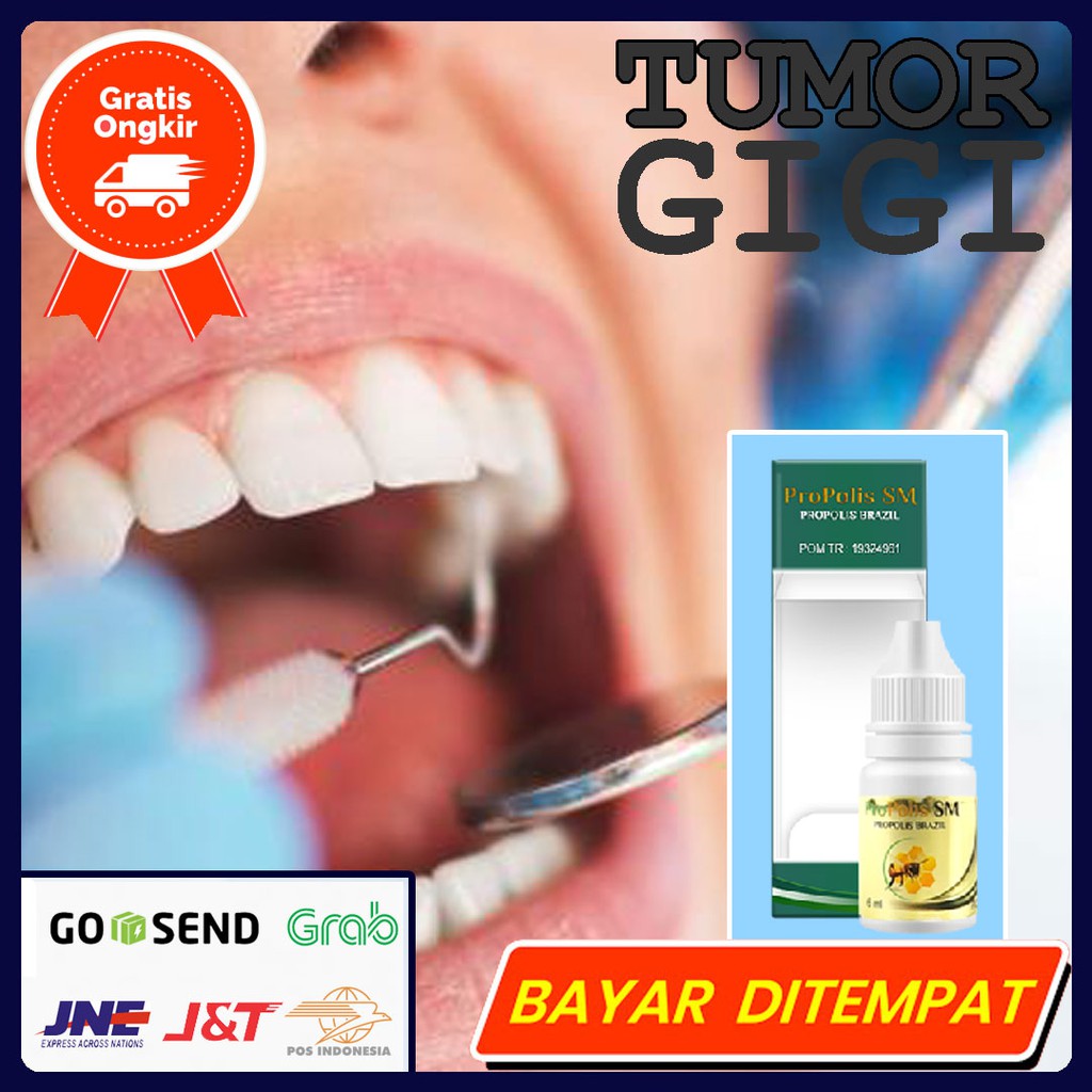 Obat Tumor Gigi - Plak Gigi - Abses Gigi Walatra Propolis SM Original 6ml