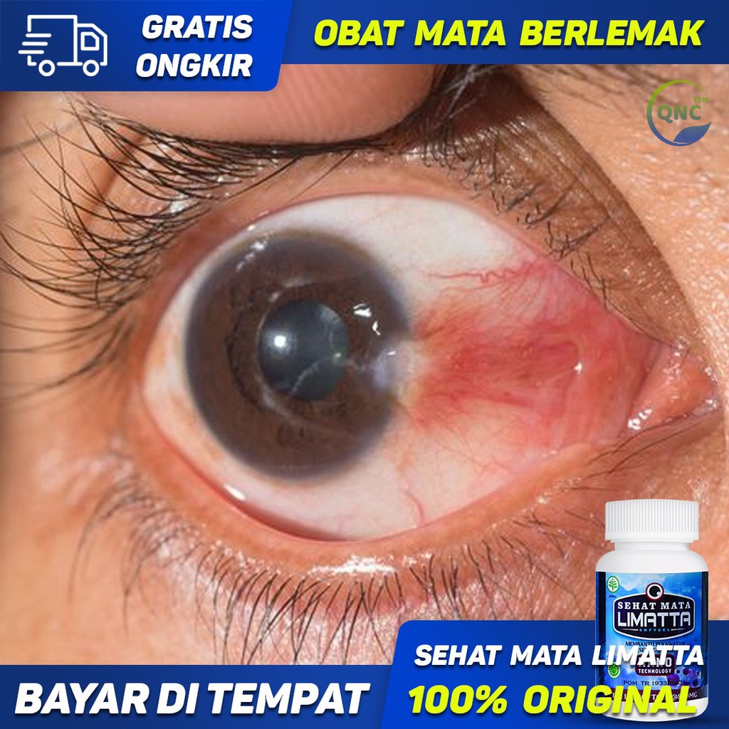 Obat Mata Berlemak, Lemak Mata, Pterigium - Sehat Mata Limatta Softgel