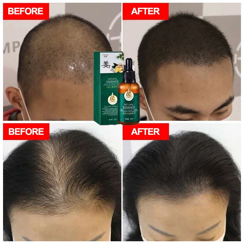 Serum Rambut Rontok Perawatan Rambut Rontok  30ml  Semprotan Pertumbuhan Rambut Memelihara akar rambut dan memperbaiki