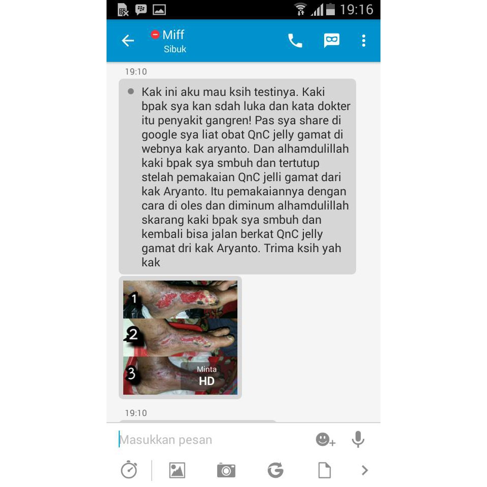 Penghilang Bekas Luka, Obat Jerawat, Eksim, Luka Bakar, Keloid, Gangren, Borok - QnC Jelly Gamat