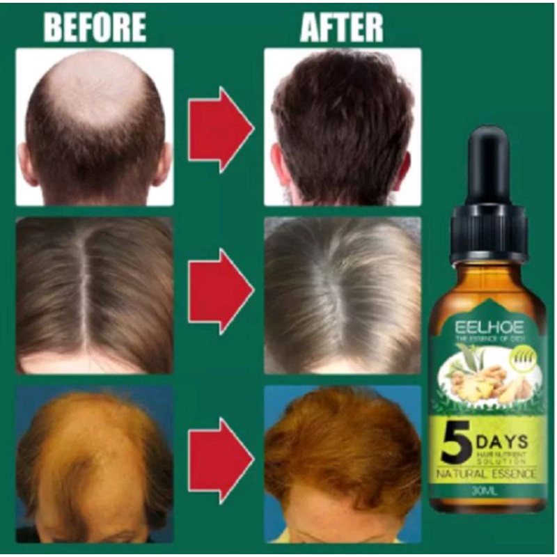 PENUMBUH RAMBUT RONTOK ANTI BOTAK SERUM RAMBUT NATURAL ESSENCE