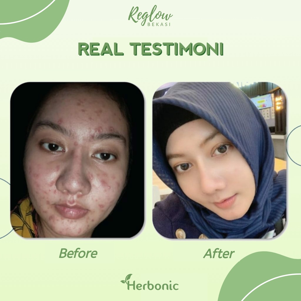REGLOW Skincare Original BPOM Glowing Skin Treatment Paket Wajah Glowing Perawatan Kecantikan Pemutih Wajah Facial Wash Toner Cream Micellar Water Pembersih Wajah Penghilang Jerawat Flek Hitam Noda Hitam Bruntusan kerutan Inflamasi-8